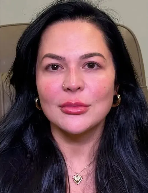 Depois do Full Face
