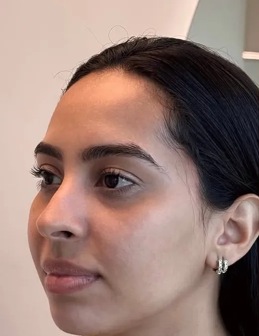 Antes do Full Face, perfil