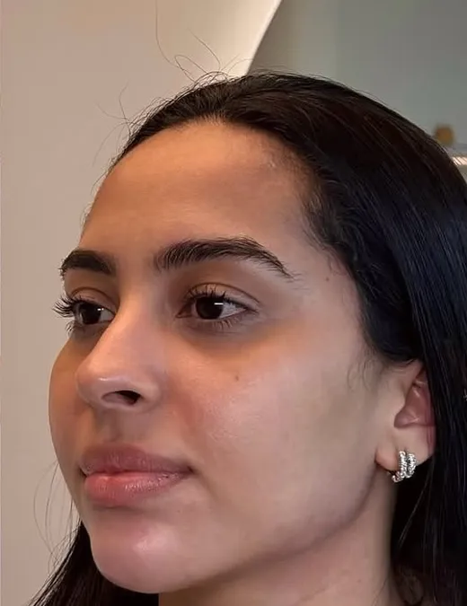 Depois do Full Face, perfil