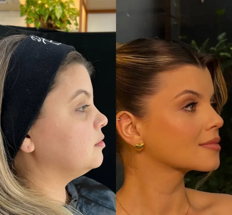 Resultado de Slim Face quase três anos depois